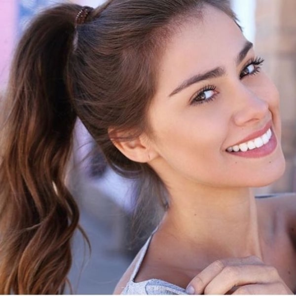 "Цвет настроения желтый": 6 причин, почему желтеют ваши зубы