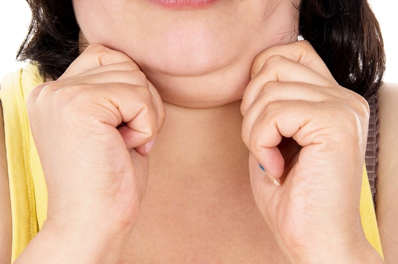 Как убрать второй подбородок в домашних условиях